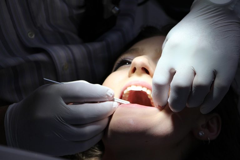 redresser ses dents sans appareil dentaire